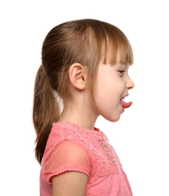 signes Dyspraxie verbale